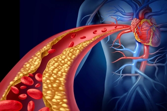Gut Bacteria and Your Heart Gut Bacteria and Your Heart