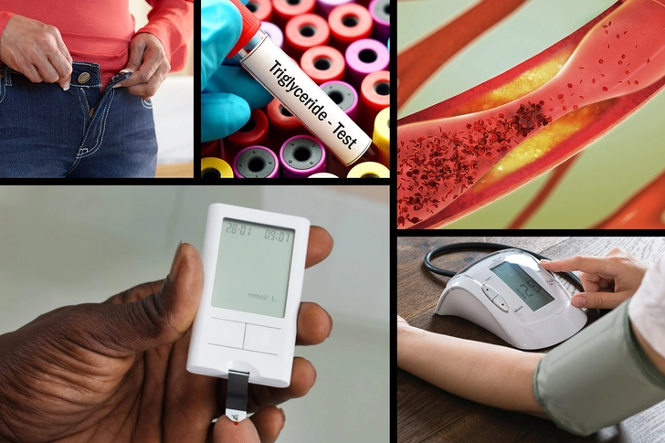 Metabolic Syndrome