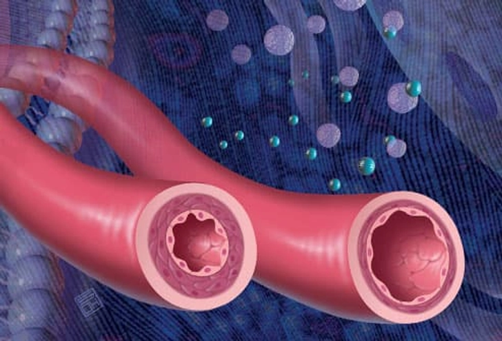 ACE Inhibitors Open Things Up ACE Inhibitors Open Things Up