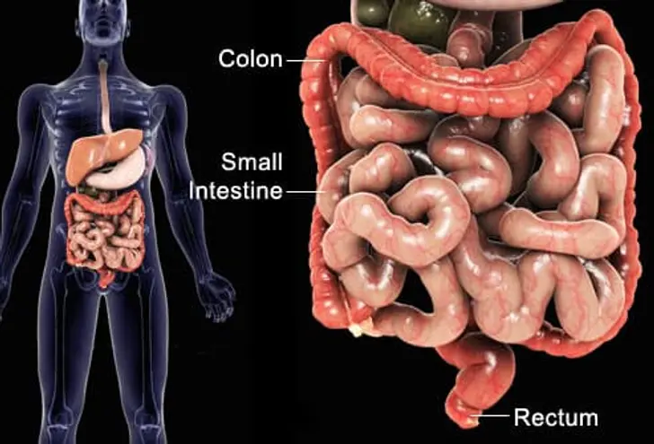 What Is Inflammatory Bowel Disease? What Is Inflammatory Bowel Disease?