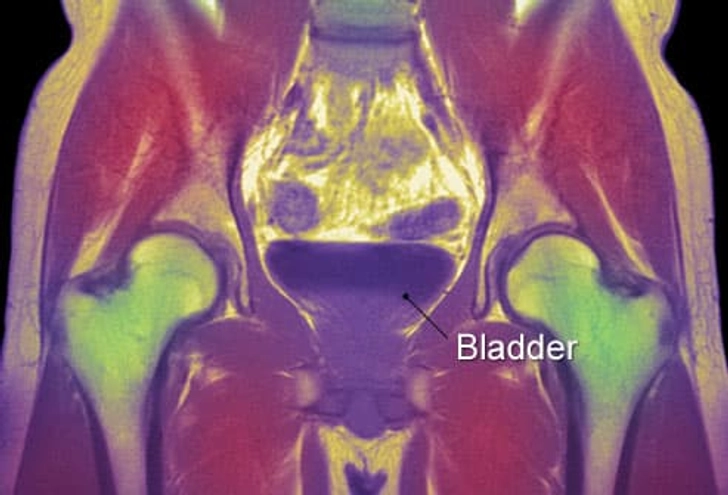 Diagnosing Incontinence: Tests