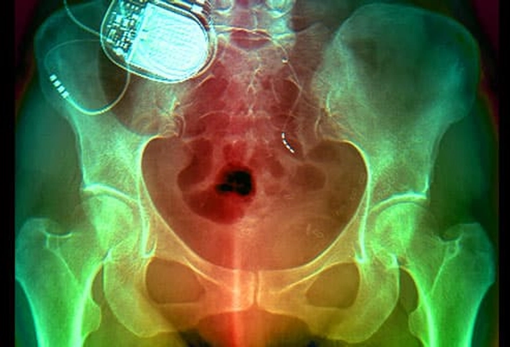 Other Treatments