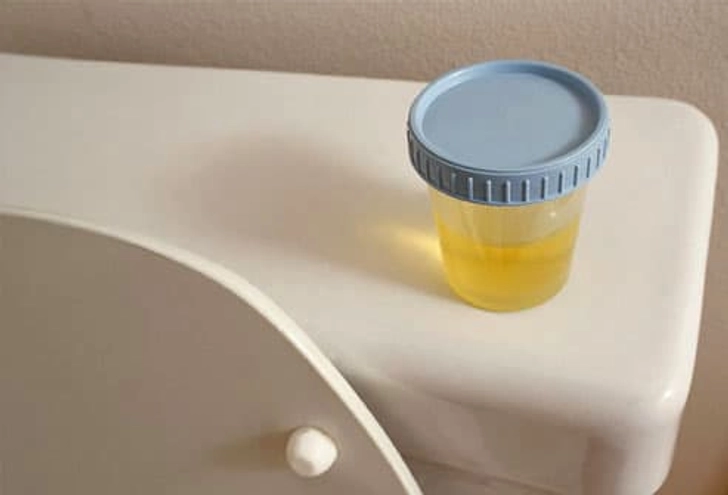 Diagnosing Incontinence Diagnosing Incontinence