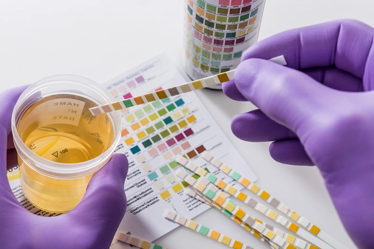 Urinary Tract Infection