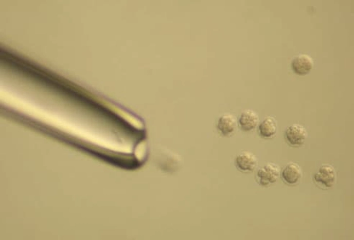 Donor Embryos Donor Embryos