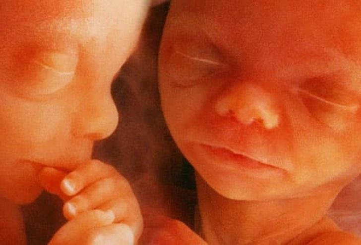 IVF Risks IVF Risks