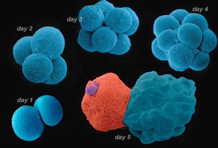 IVF With Blastocyst Transfer IVF With Blastocyst Transfer