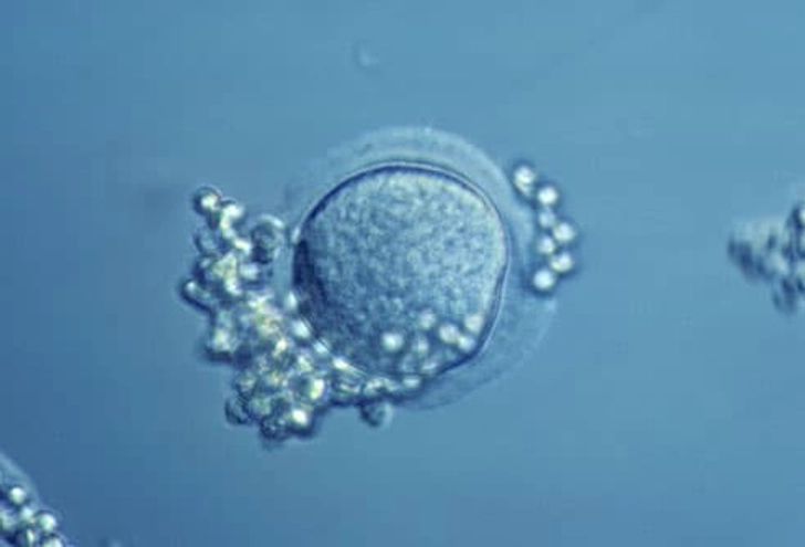 IVF With a Donor Egg IVF With a Donor Egg