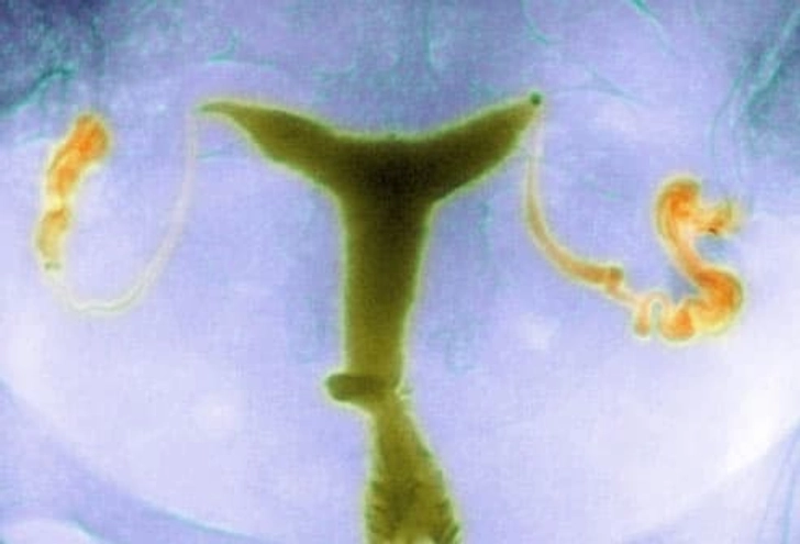 Surgery for Blocked Fallopian Tubes Surgery for Blocked Fallopian Tubes