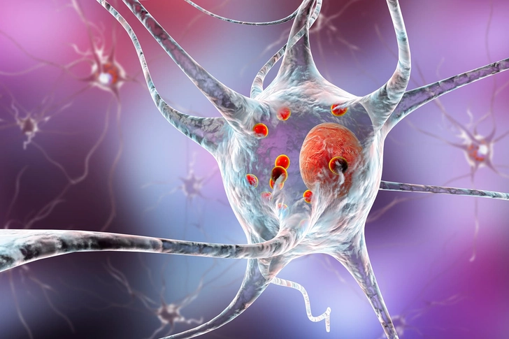 Parkinson's Disease Parkinson's Disease