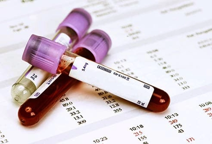 Diagnosis Diagnosis