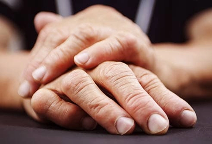 Related Illnesses Related Illnesses