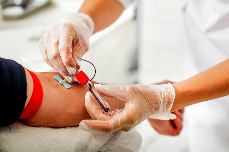 Check for Liver Damage Check for Liver Damage