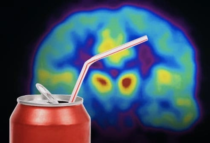 Can You Really Be Hooked on Sugar?