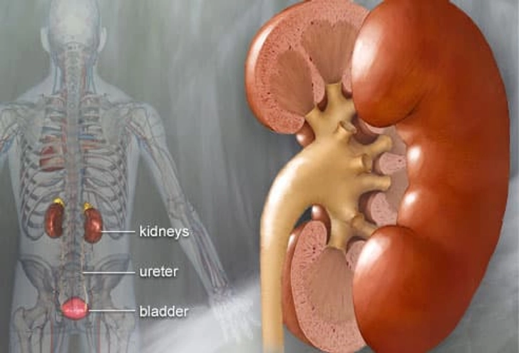 Kidney Stone Symptoms