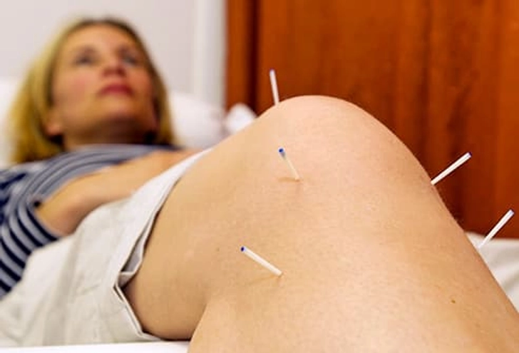 Do: Consider Acupuncture