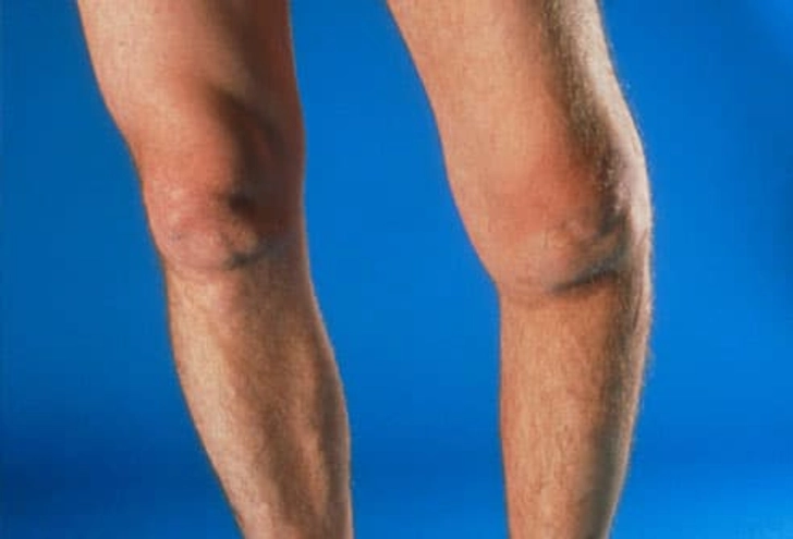 When to Consider Surgery