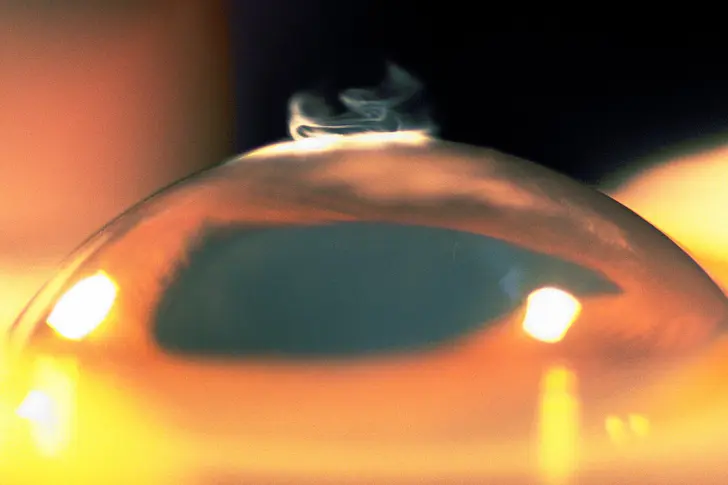 What Is Vision Correction Surgery? What Is Vision Correction Surgery?