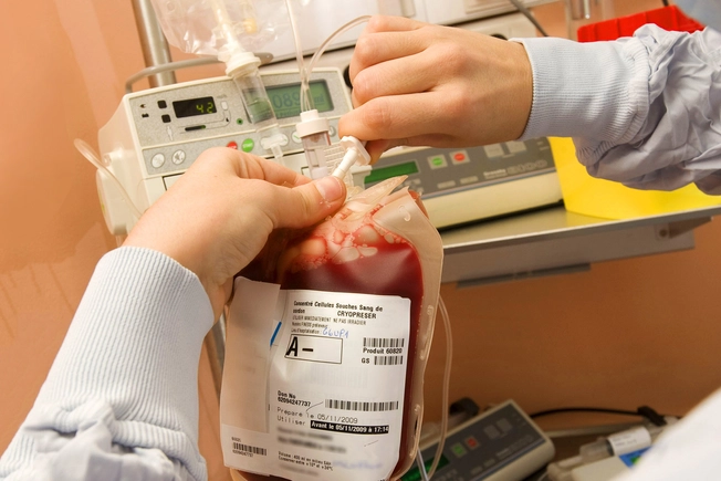 Stem Cell Transplant