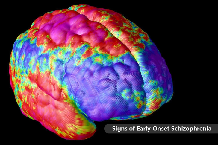 Brain Disorders