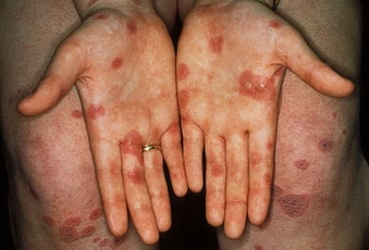 Skin Problems Skin Problems