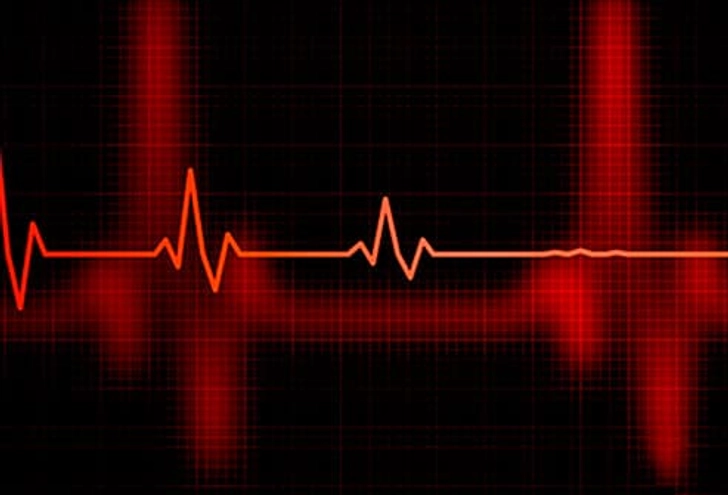 Poor Heart Health Poor Heart Health