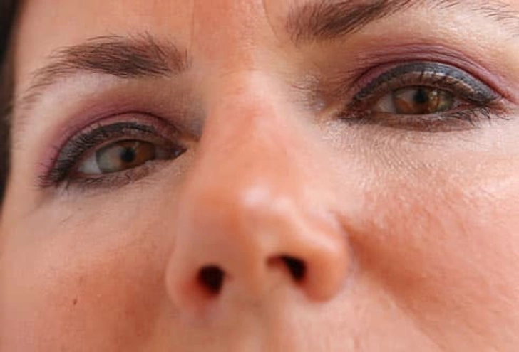 Avoid Clown Eyes