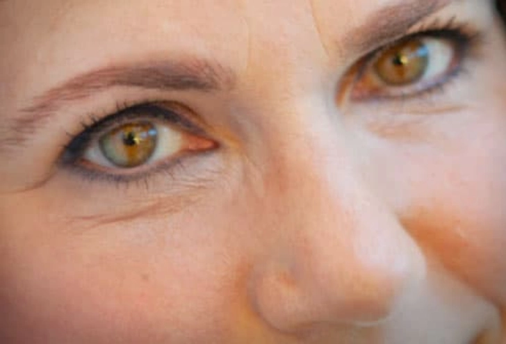Enhance the Shape of the Eye