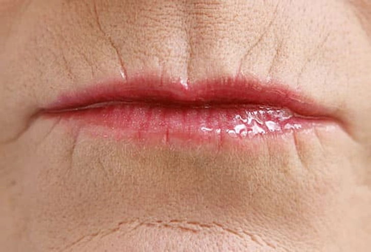 Don't Let the Lips 'Bleed'