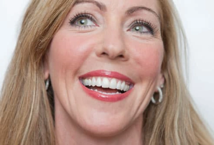 Whiten Stained Teeth