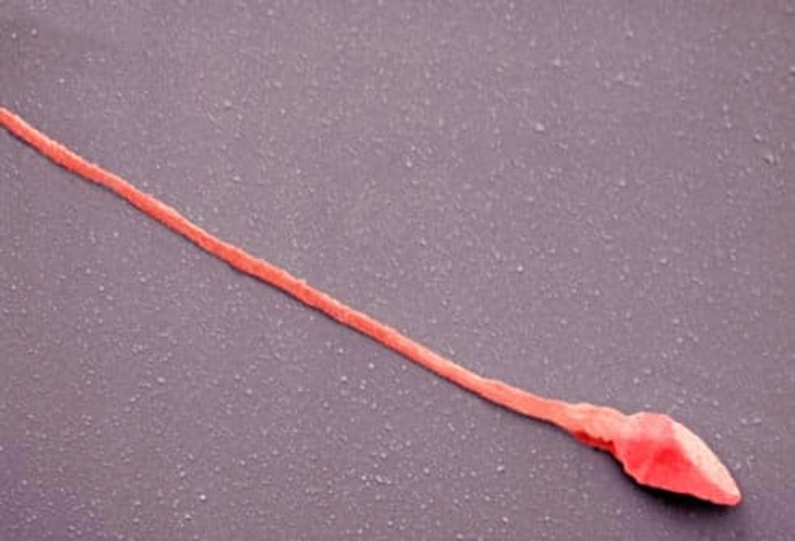Low Testosterone and Infertility
