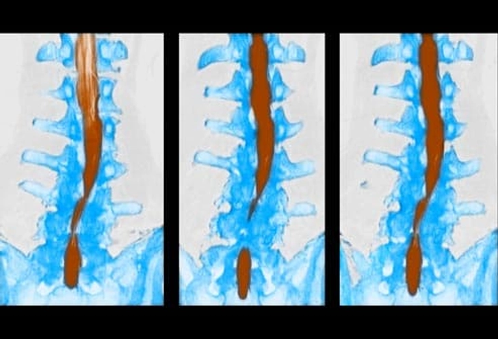 Back Pain Culprit: Chronic Conditions Back Pain Culprit: Chronic Conditions