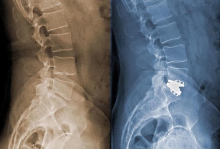 Surgery Surgery
