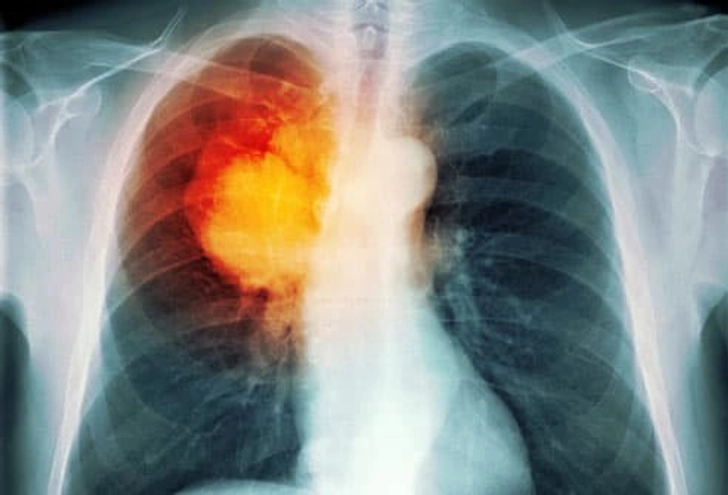 Diagnosis Diagnosis