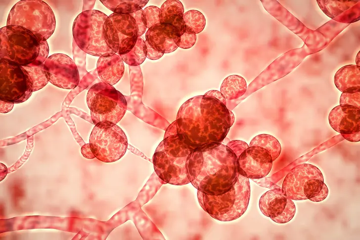 Infections