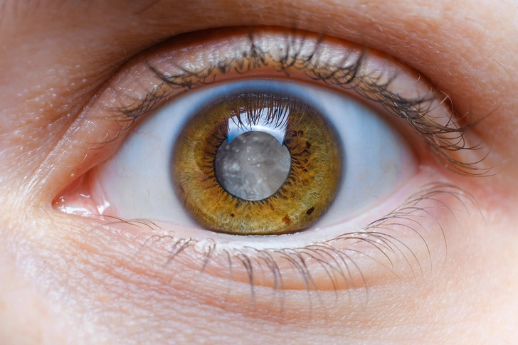 Eye Problems