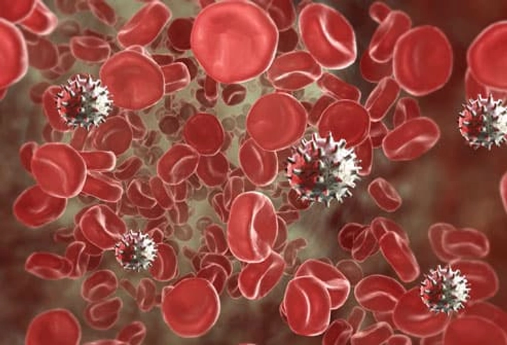 Lupus and Anemia