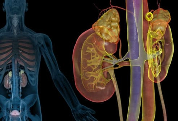 Lupus and Kidney Problems Lupus and Kidney Problems
