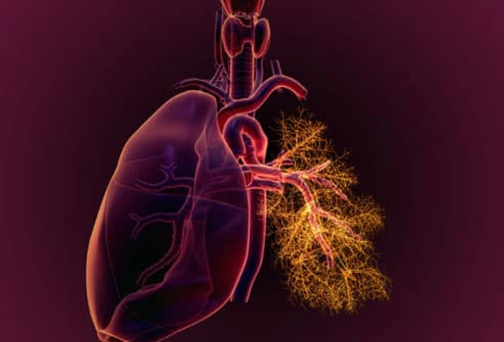 Lupus and Lung Problems Lupus and Lung Problems