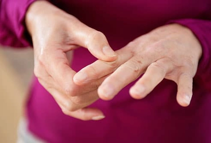 Lupus or Something Else? Lupus or Something Else?