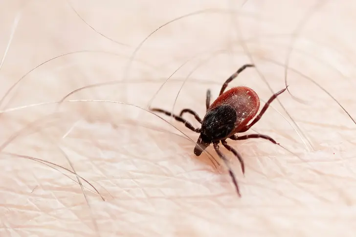 What Is Lyme Disease?
