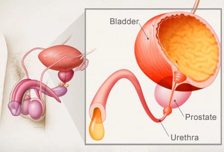 What Causes Male Incontinence What Causes Male Incontinence
