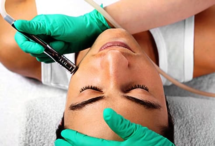 Microdermabrasion Microdermabrasion