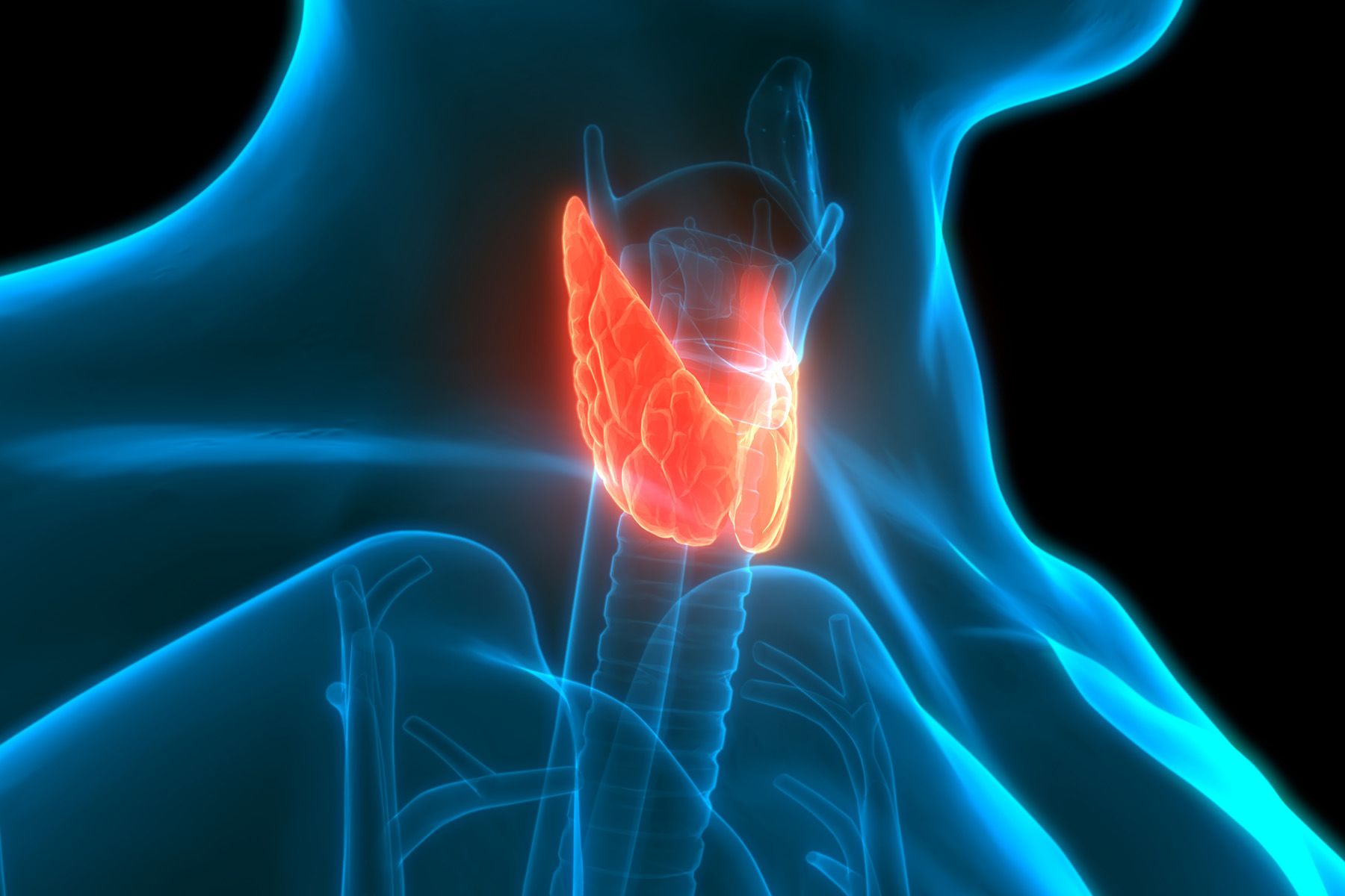 photo of thyroid