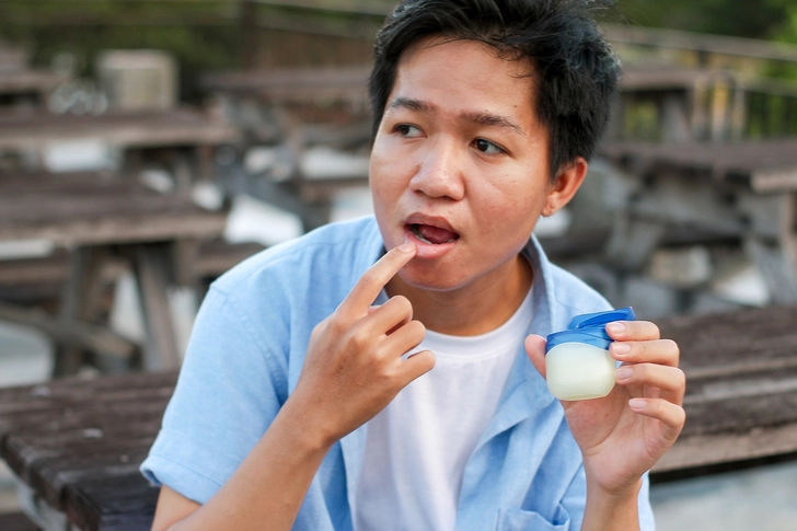 Avoid UV Light and Dry Lips