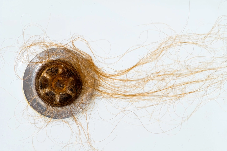 Hair Loss Hair Loss