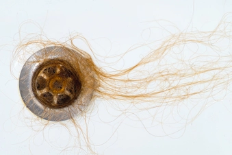 Hair Loss