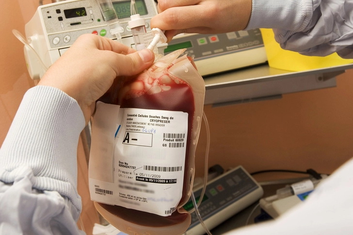 Stem Cell Transplant