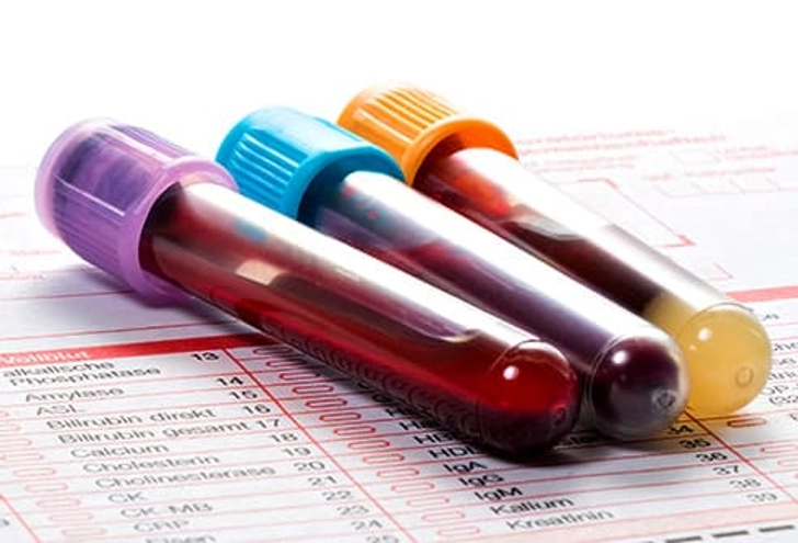 Delay in Treatment
