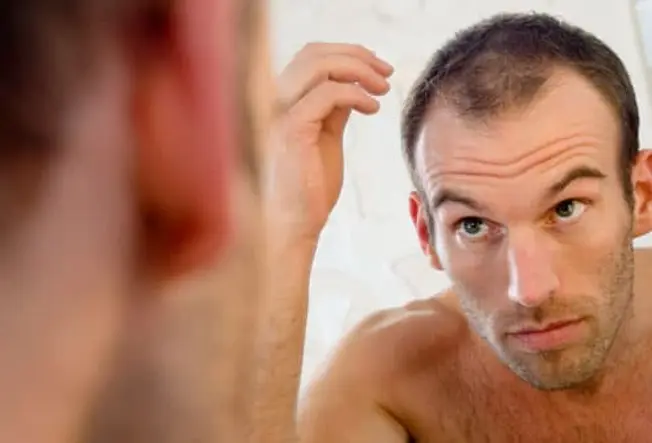 Hair Loss: A Common Problem